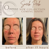 Dermastart: Clearchoice Coppertide Mist
